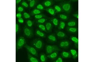 Immunofluorescence (IF) image for anti-Telomeric Repeat Binding Factor 2, Interacting Protein (TERF2IP) (AA 1-280) antibody (ABIN7270764)