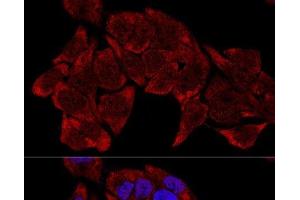 Confocal immunofluorescence analysis of HeLa cells using RPL8 Polyclonal Antibody at dilution of 1:200. (RPL8 抗体)