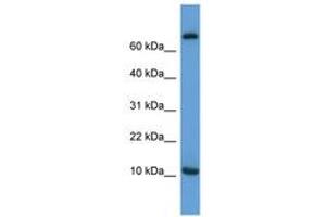 Image no. 1 for anti-Chemokine (C-C Motif) Ligand 20 (CCL20) (AA 31-80) antibody (ABIN6746017) (CCL20 抗体  (AA 31-80))