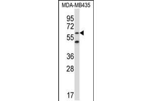 Western blot analysis in MDA-MB435 cell line lysates (35ug/lane). (ZNF479 抗体  (N-Term))