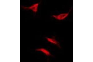Immunofluorescence (fixed cells) (IF/ICC) image for anti-Acylphosphatase 2, Muscle Type (Acyp2) (Internal Region) antibody (ABIN6259762)