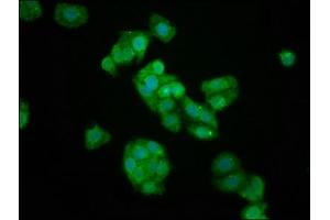 Immunofluorescence staining of HepG2 cells with ABIN7157575 at 1:133, counter-stained with DAPI. (KIFAP3 抗体  (AA 660-792))