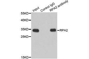 Immunoprecipitation analysis of 200ug extracts of Jurkat cells using 1ug RPA2 antibody. (RPA2 抗体)