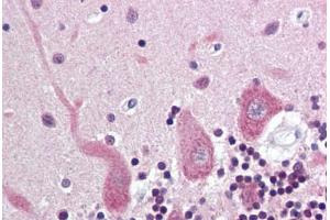 Human Brain, Cerebellum (formalin-fixed, paraffin-embedded) stained with Synuclein Alpha/Beta antibody ABIN337058 at 5-10 ug/ml followed by biotinylated anti-mouse IgG secondary antibody ABIN481714, alkaline phosphatase-streptavidin and chromogen. (Alpha, beta Synuclein 抗体)