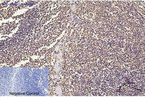 Immunohistochemical analysis of paraffin-embedded human tonsil tissue. (CD68 抗体)