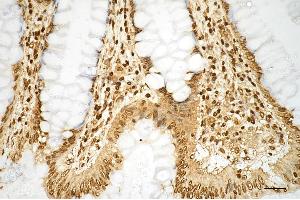 Immunohistochemistry was performed on paraffin-embedded human sigmoid colon carcinoma using histone H3 (mono methyl K9) antibody (ABIN7798962), 1:200). (Recombinant Histone 3 抗体  (H3K9me1))
