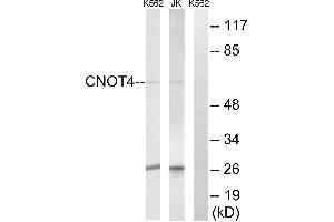 Immunohistochemistry analysis of paraffin-embedded human testis tissue, using CNOT4 antibody. (CNOT4 抗体)