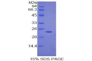 SDS-PAGE analysis of Rat Cathepsin G Protein. (Cathepsin G Protein (CTSG))