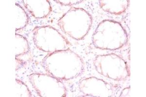 Immunohistochemistry (IHC) image for anti-Prolyl 4-Hydroxylase, beta Polypeptide (P4HB) (AA 29-508) antibody (ABIN7165284)