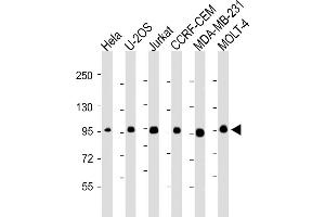 All lanes : Anti-RANBP9 Antibody at 1:2000-1:4000 dilution Lane 1: Hela whole cell lysate Lane 2: U-2OS whole cell lysate Lane 3: Jurkat whole cell lysate Lane 4: CCRF-CEM whole cell lysate Lane 5: MDA-MB-231whole cell lysate Lane 6: MOLT-4 whole cell lysate Lysates/proteins at 20 μg per lane. (Importin 9 抗体  (AA 1-388))