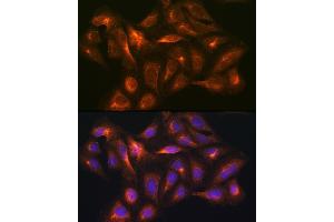 Immunofluorescence (IF) image for anti-Glutamate Decarboxylase 1 (Brain, 67kDa) (GAD1) (AA 1-200) antibody (ABIN3017019)