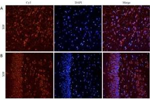 IHC staining of FFPE rat cerebral cortex [A] and rat hippocampus [B] with CHRNA antibody at 5ug/ml (CHRNA7 抗体)