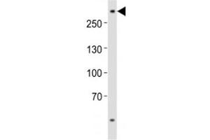 Western Blotting (WB) image for anti-ATP-Binding Cassette, Sub-Family A (ABC1), Member 2 (ABCA2) (AA 1339-1373) antibody (ABIN5647437)