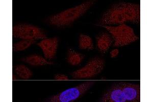 Confocal immunofluorescence analysis of U2OS cells using TAZ Polyclonal Antibody at dilution of 1:100 (60x lens). (TAZ 抗体)