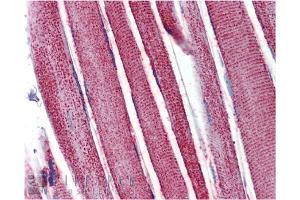 Immunohistochemistry analysis of human skeletal muscle tissue stained with Mn SOD, pAb at 10 μg/mL. (SOD2 抗体)