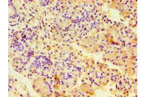 Immunohistochemistry of paraffin-embedded human pancreatic tissue using ABIN7146703 at dilution of 1:100 (CA12 抗体  (AA 25-301))