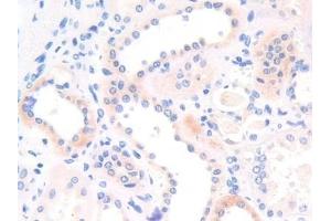 Immunohistochemistry (IHC) image for anti-Perilipin 2 (PLIN2) (AA 245-433) antibody (ABIN7438550)
