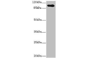 Western blot All lanes: TGFBR3 antibody IgG at 2. (TGFBR3 抗体  (AA 140-340))