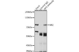 Immunoprecipitation (IP) image for anti-Neurofibromin 2 (NF2) (AA 477-576) antibody (ABIN6144548)