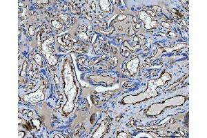 IHC analysis of TP53I13 using anti-TP53I13 antibody (ABIN7601220). (TP53I13 抗体  (AA 30-365))
