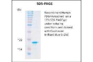 SDS-PAGE (SDS) image for Platelet Derived Growth Factor A (PDGFA) (Active) protein (ABIN5509326) (PDGFA 蛋白)