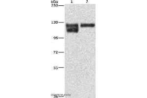 Western blot analysis of A172 cell and human leiomyosarcoma tissue, using ITGB1 Polyclonal Antibody at dilution of 1:600 (ITGB1 抗体)
