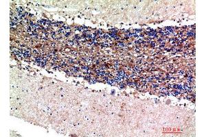 Immunohistochemistry (IHC) analysis of paraffin-embedded Human Brain, antibody was diluted at 1:200. (S100A1 抗体)