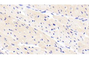 Immunohistochemistry (IHC) image for anti-Tenascin XB (TNXB) (AA 3835-4088) antibody (ABIN7434377)
