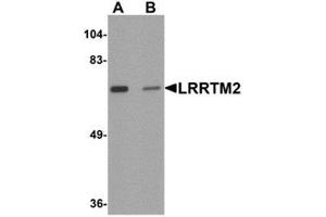 Western blot analysis of LRRTM2 in SK-N-SH cell lysate with LRRTM2 antibody at 1 μg/ml in (A) the absence and (B) the presence of blocking peptide. (LRRTM2 抗体  (C-Term))