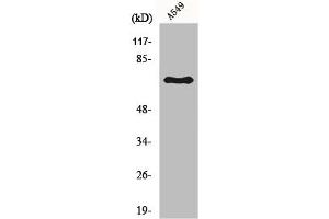 Western Blot analysis of A549 cells using Frizzled-3 Polyclonal Antibody (FZD3 抗体  (Internal Region))