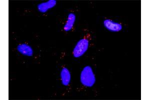 Proximity Ligation Assay (PLA) image for anti-Cas-Br-M (Murine) Ecotropic Retroviral Transforming Sequence (CBL) (AA 1-906) antibody (ABIN514071)
