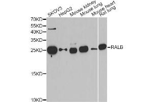 Western blot analysis of extracts of various cell lines, using RALB antibody. (RALB 抗体)
