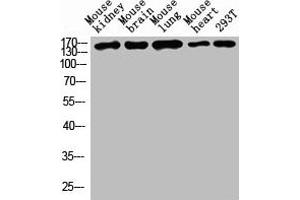 Western blot analysis of Mouse kidney tissue, Mouse brain tissue, Mouse lung tissue, Mouse heart tissue, 293T whole cell lysate, antibody was diluted at 1000. (Desmoglein 1 抗体  (AA 30-90))