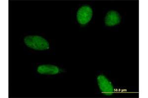 Immunofluorescence of purified MaxPab antibody to EMD on HeLa cell. (Emerin 抗体  (AA 1-254))