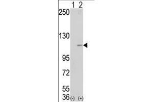 Western blot analysis of AOF2 (arrow) using LSD1 Antibody (Center) (ABIN388022 and ABIN2845464). (LSD1 抗体  (AA 457-490))