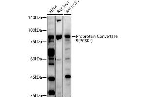 Western blot analysis of extracts of various cell lines, using Proprotein Convertase 9(PCSK9) antibody (ABIN6133851, ABIN6145328, ABIN6145330 and ABIN6223837) at 1:1000 dilution. (PCSK9 抗体  (C-Term))