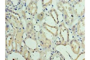 Immunohistochemistry of paraffin-embedded human kidney tissue using ABIN7159569 at dilution of 1:100 (METRNL 抗体  (AA 46-311))