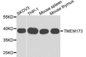 Western blot analysis of extracts of various cell lines, using TMEM173 antibody. (STING/TMEM173 抗体  (AA 170-379))