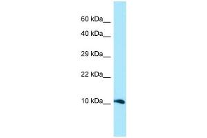 WB Suggested Anti-GGNBP1 Antibody Titration: 1. (GGNBP1 抗体  (N-Term))