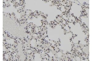 ABIN6273089 at 1/100 staining Rat lung tissue by IHC-P. (AEBP2 抗体  (Internal Region))
