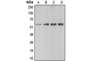 Western blot analysis of Caspase 10 expression in HeLa (A), Jurkat (B), mouse heart (C), rat heart (D) whole cell lysates. (Caspase 10 抗体  (C-Term))