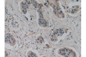 Immunohistochemistry (IHC) image for anti-Glutamate Decarboxylase 2 (Pancreatic Islets and Brain, 65kDa) (GAD2) (AA 65-105) antibody (ABIN7433339)