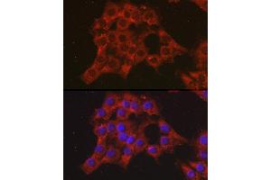 Immunofluorescence analysis of C6 cells using CCL3 Rabbit pAb (ABIN6130184, ABIN6138061, ABIN6138062 and ABIN6223474) at dilution of 1:100 (40x lens). (CCL3 抗体  (AA 24-92))