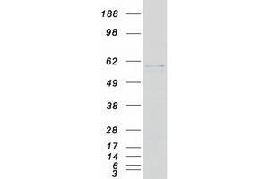 Western Blotting (WB) image for Fukutin (FKTN) (Transcript Variant 1) protein (Myc-DYKDDDDK Tag) (ABIN2721450)