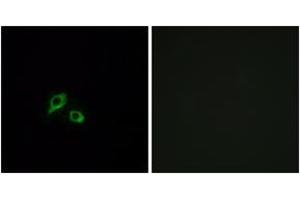 Immunofluorescence analysis of MCF7 cells, using GIPR Antibody. (GIPR 抗体  (AA 93-142))