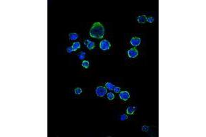 Immunofluorescence analysis of RAJI cells using CD1A mouse mAb (green). (CD1a 抗体)