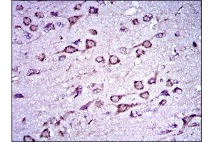 Immunohistochemistry (IHC) image for anti-Doublecortin (DCX) (AA 362-411) antibody (ABIN1844030) (Doublecortin 抗体  (AA 362-411))