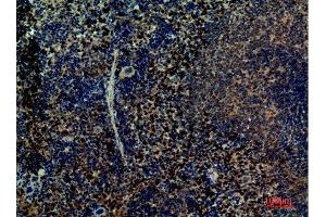 Immunohistochemistry (IHC) image for anti-Integrin alpha 4 (ITGA4) (Internal Region) antibody (ABIN6287306)