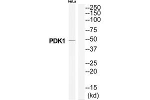 Western Blotting (WB) image for anti-3-phosphoinositide Dependent Protein Kinase-1 (PDPK1) (Internal Region) antibody (ABIN1851913) (PDPK1 抗体  (Internal Region))