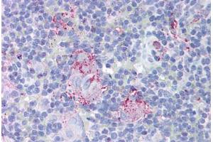 Human Thymus (formalin-fixed, paraffin-embedded) stained with MTBP antibody ABIN213954 at 10 ug/ml followed by biotinylated goat anti-rabbit IgG secondary antibody ABIN481713, alkaline phosphatase-streptavidin and chromogen. (MTBP 抗体  (AA 122-139))